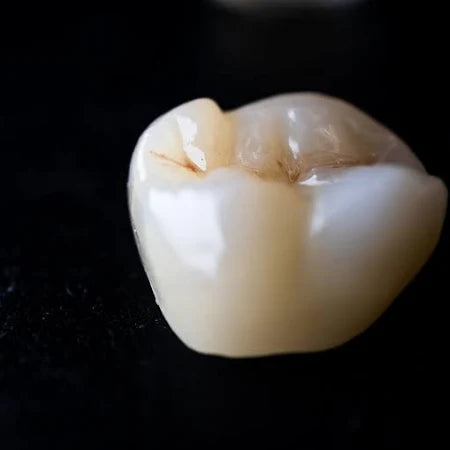 HT Zirconia (Full Contour)